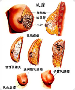 乳腺疾病的症状有哪些?